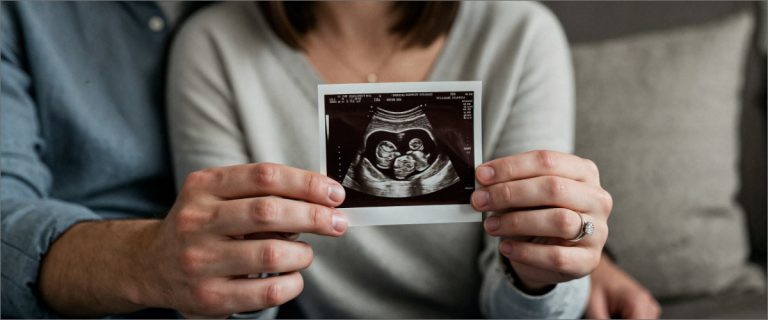 Gestante realizando ultrassom obstétrico