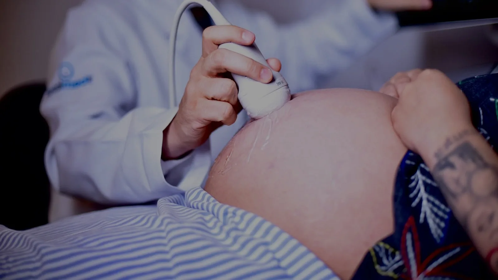 Acretismo placentário: o que é, quem tem risco e por que o diagnóstico pré-natal importa