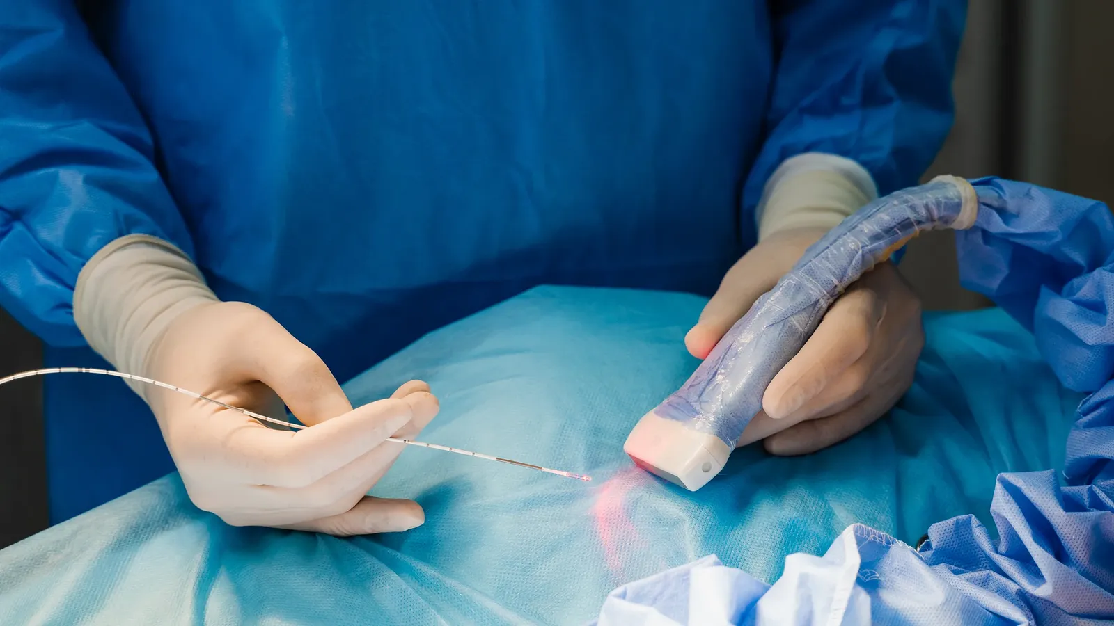 Laser placentário para transfusão feto-fetal: como funciona