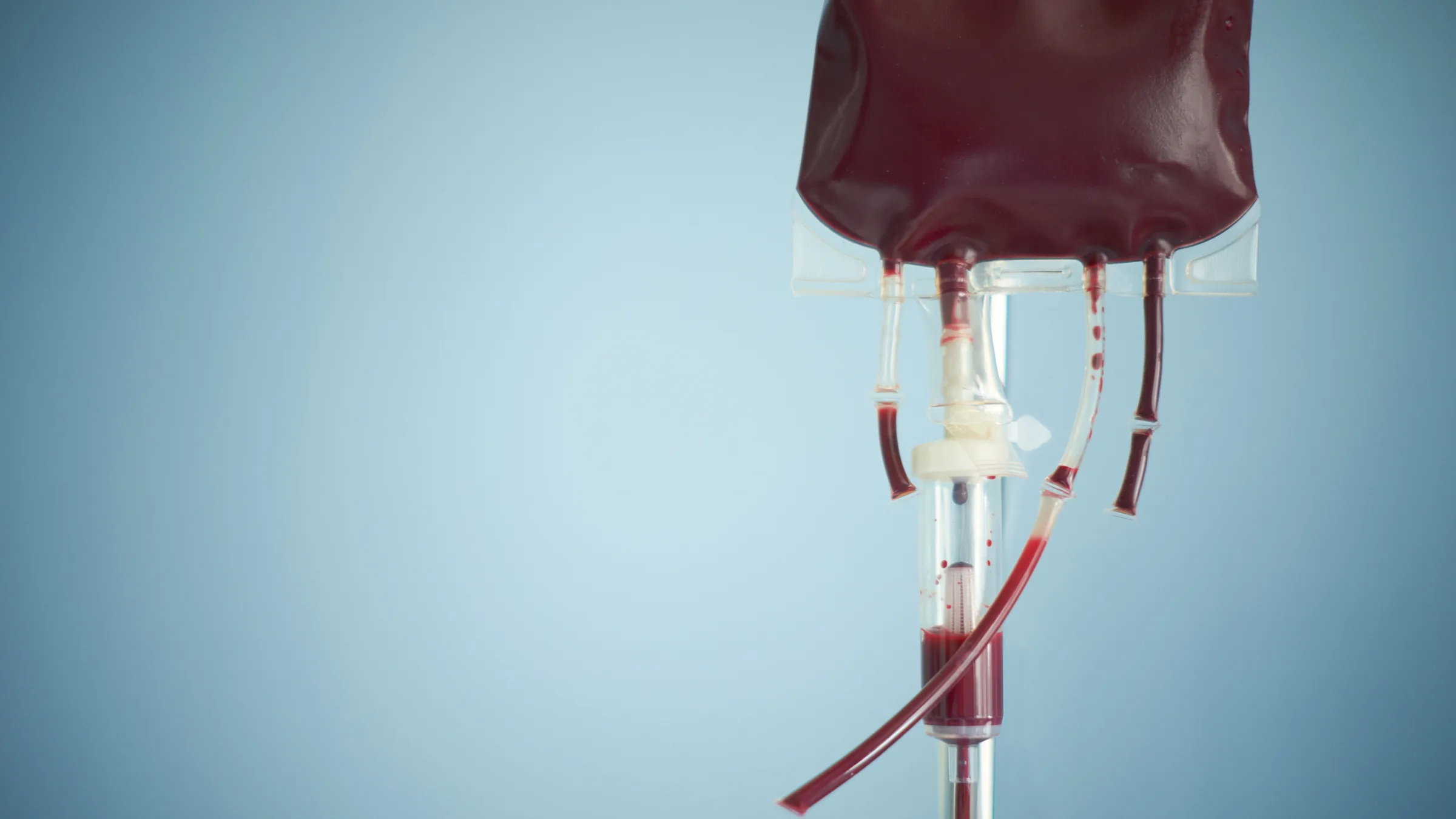 Diagnóstico de anemia fetal por Doppler da artéria cerebral média — avaliação especializada em medicina fetal