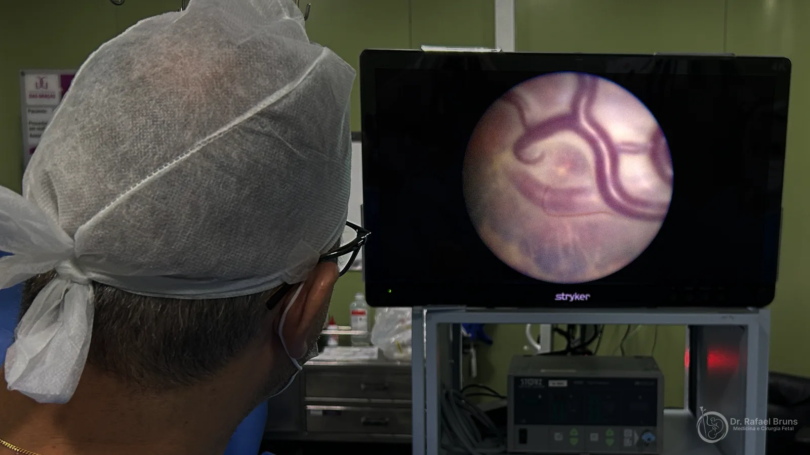 Dr. Rafael Bruns observando anastomoses placentárias no monitor durante cirurgia fetoscópica para tratamento da síndrome de transfusão feto-fetal