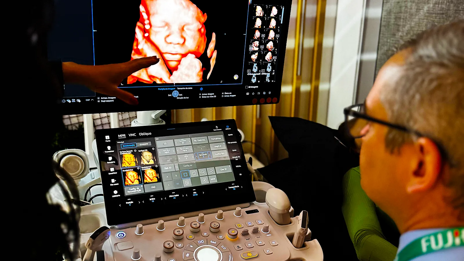 Dr. Rafael Bruns avaliando equipamento de ultrassom de última geração durante a Jornada Paulista de Radiologia 2025