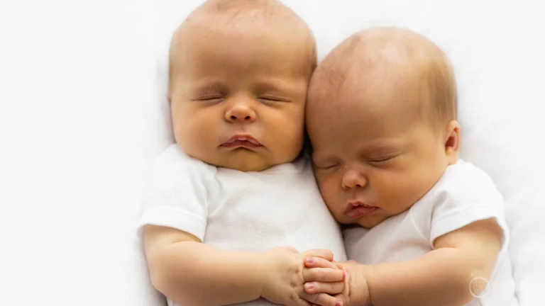 Gêmeos recém-nascidos dormindo lado a lado após tratamento bem-sucedido para síndrome de transfusão feto-fetal