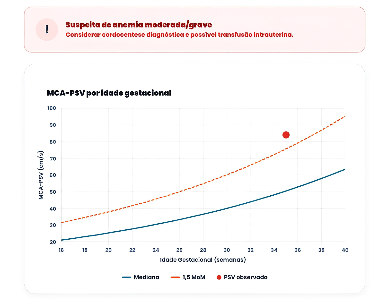 Gráfico da curva de referência do pico de velocidade sistólica da artéria cerebral média por idade gestacional, com mediana e limiar de 1,5 MoM — caso observado de 84 cm/s em 35 semanas acima do limiar para anemia fetal