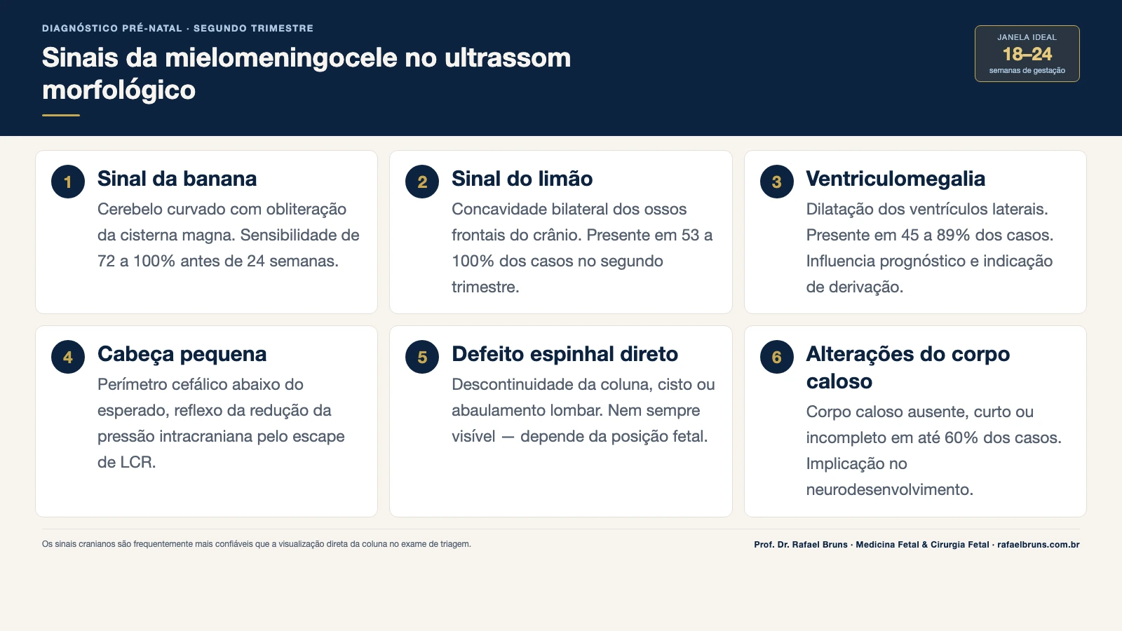 Infográfico com os 6 sinais da mielomeningocele identificados no ultrassom morfológico do segundo trimestre