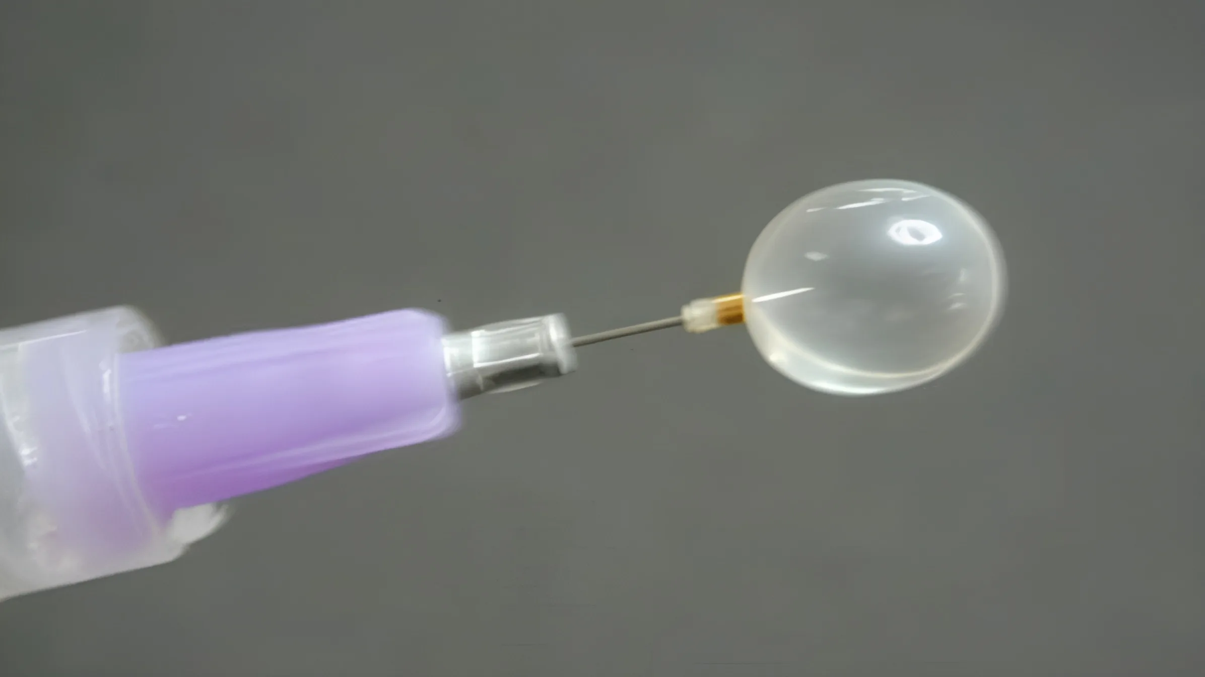 Oclusão traqueal fetal (FETO): como o balão na traqueia ajuda os pulmões a crescer