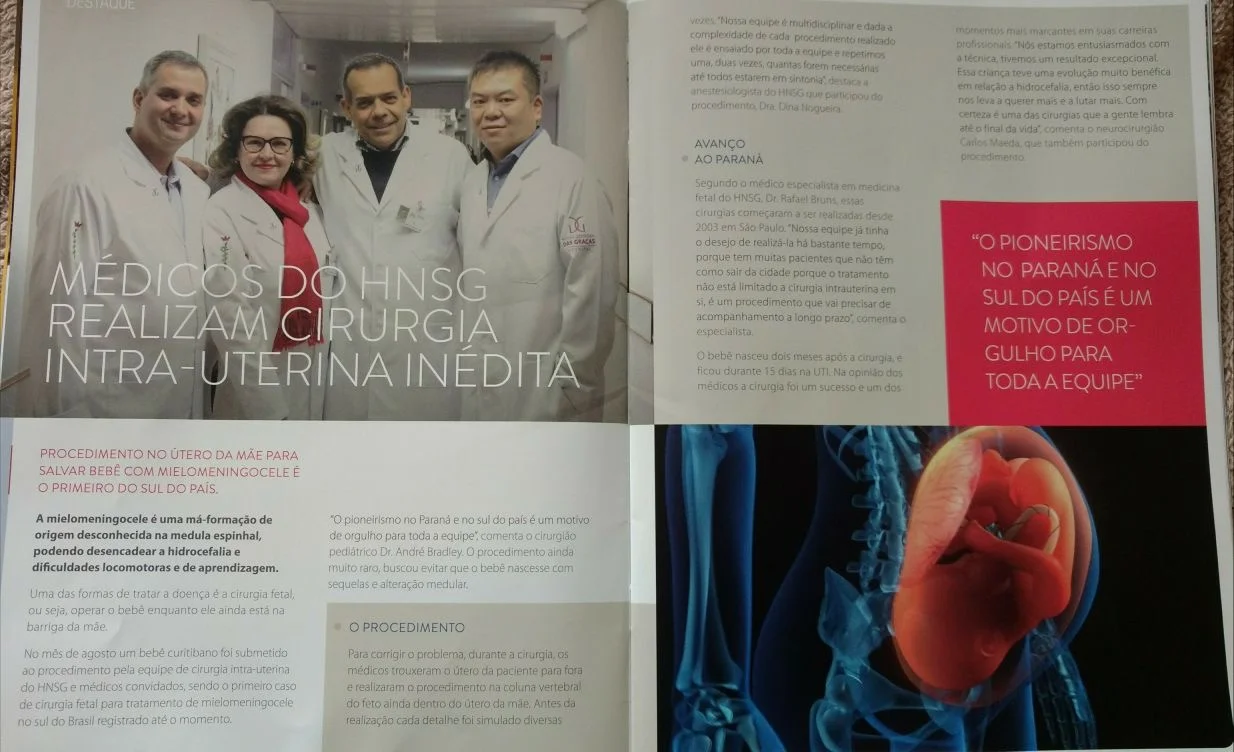 Reportagem publicada na revista do Hospital Nossa Senhora das Graças sobre a primeira cirurgia fetal de mielomeningocele realizada no Paraná em 2017