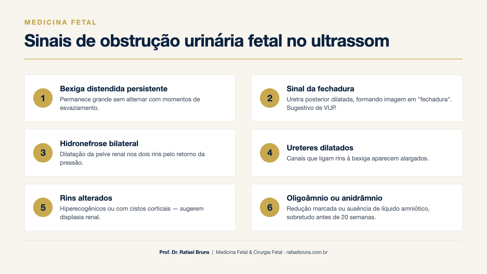 Infográfico dos sinais ultrassonográficos da obstrução urinária fetal: bexiga distendida, sinal da fechadura, hidronefrose bilateral, ureteres dilatados, rins alterados e oligoâmnio