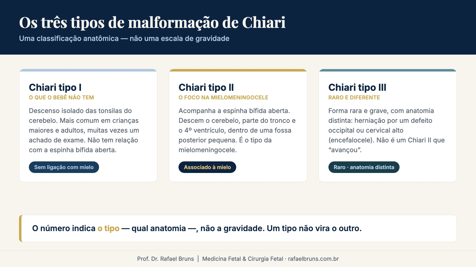 Comparação dos três tipos de malformação de Chiari (I, II e III) mostrando que são anatomias distintas, e não estágios de gravidade