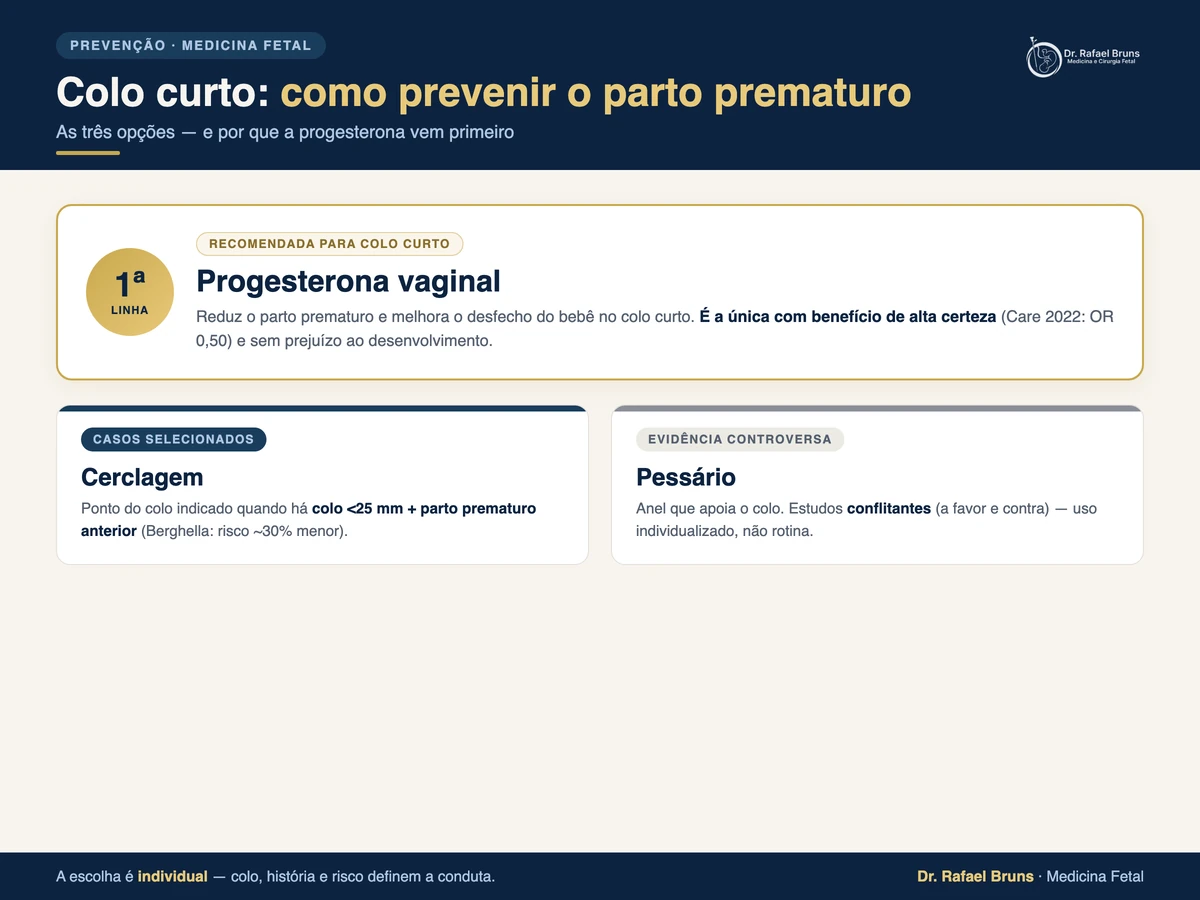 Infográfico: como prevenir o parto prematuro no colo curto — progesterona vaginal (primeira linha), cerclagem (colo curto com parto prematuro prévio) e pessário (evidência controversa)