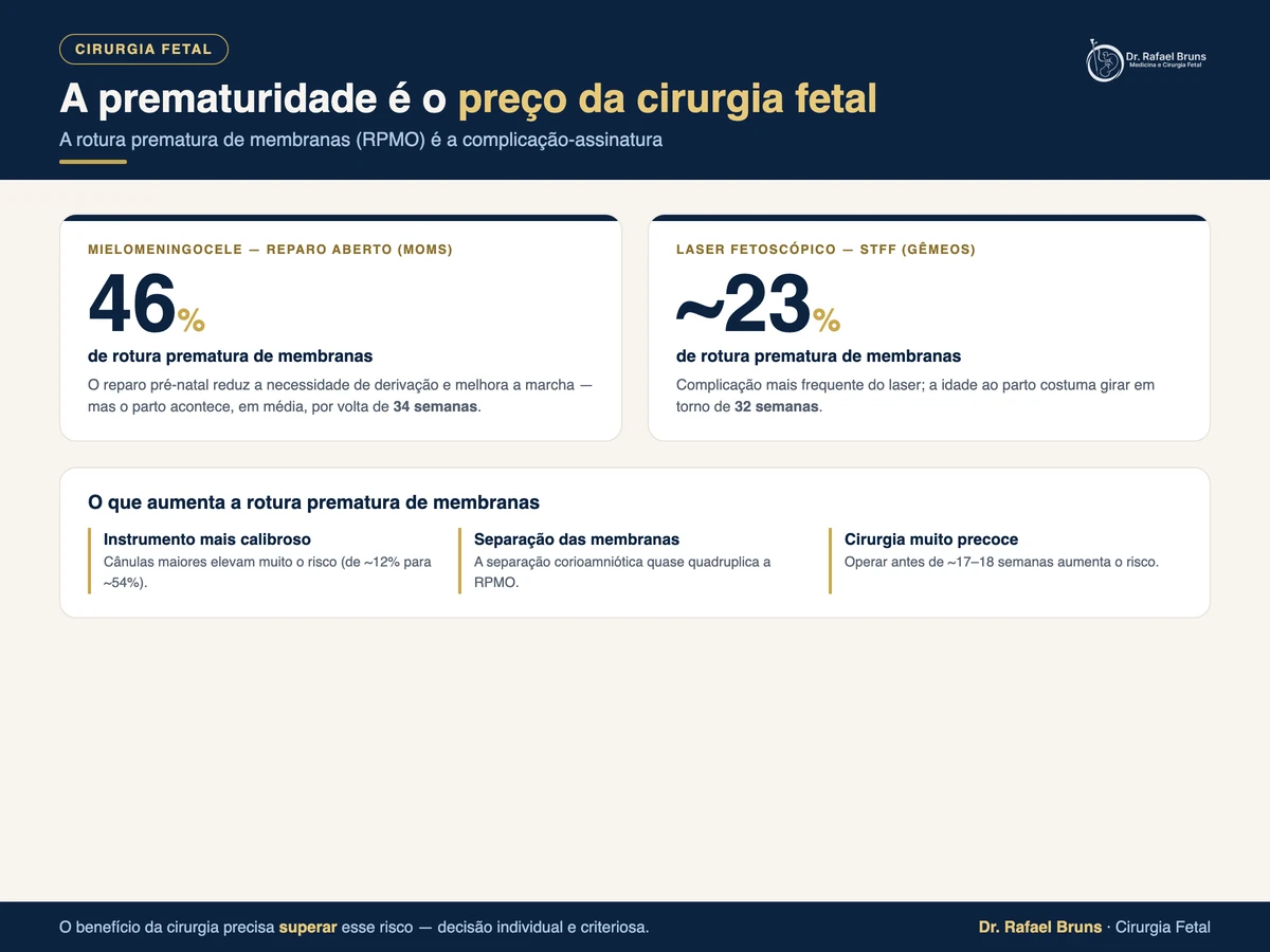 Infográfico: a prematuridade e a rotura prematura de membranas como principal complicação da cirurgia fetal — mielomeningocele aberta (MOMS) e laser fetoscópico