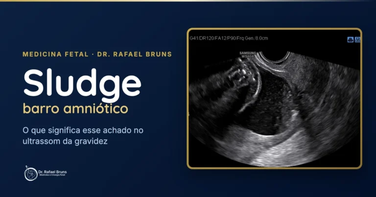 Sludge (barro amniótico): o que significa esse achado no ultrassom — Dr. Rafael Bruns